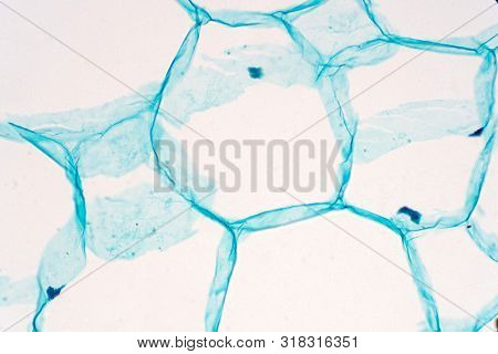 Cross Sections Of Plant Stem Under Microscope View Show Structure Of Parenchyma Cells For Education 