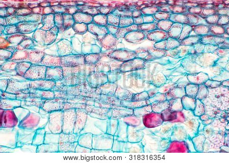Cross Sections Of Plant Stem Under Microscope View Show Structure Of Collenchyma Cells For Education