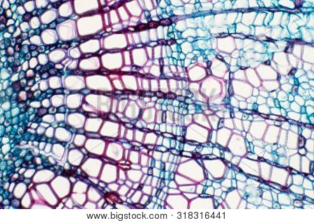 Cross Section - Xylem Is A Type Of Tissue In Vascular Plants That Transports Water And Some Nutrient