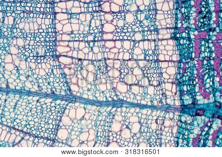 Cross Section - Xylem Is A Type Of Tissue In Vascular Plants That Transports Water And Some Nutrient