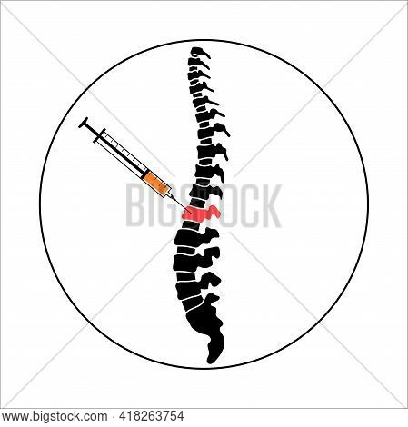 Spine Joint Injection. Pain And Inflammation In The Vertebra. Spinal Arthritis Disease Concept. Medi