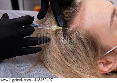 A Blonde Woman With Dyed Hair Suffers From Hair Loss And Receives Mesotherapy Injections In Her Head