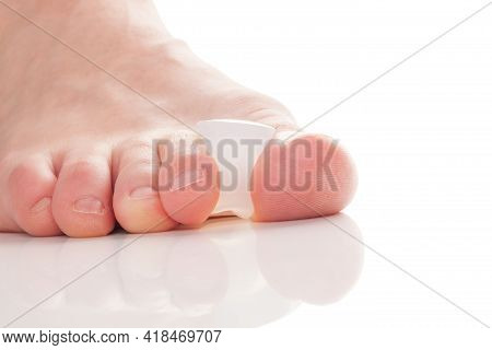 Bunion, Hallux Valgus. Silicone Finger Toe Separator On Feet Isolated On White Background.