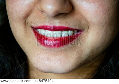 Stock Photo Of 20 To 25 Aged Beautiful Indian Girl Smile With Healthy White Teeth, Girl Apply Dark P