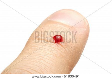 Finger Wound On White Background