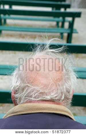 Baldness