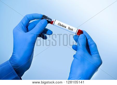 Positive result of blood test for cholera. Test tube with a blood test in the doctor's hands. Medical concept.