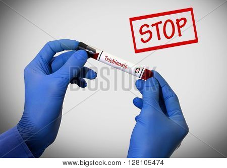 Stop trichinosis. Positive result of blood test. Test tube with a blood test in the doctor's hands. Medical concept.