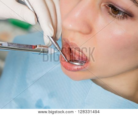 The reception was at the female dentist. Doctor examines the oral cavity on tooth decay. Caries protection. doctor puts the patient an anesthetic injection. close-up of the patient's mouth and squirt.