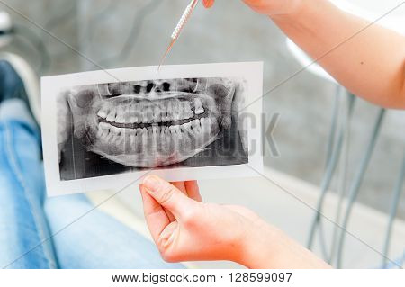 Dentist looking at x-ray picture in the office