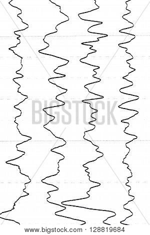 Electroencephalography test that shows electrical activity of the brain.