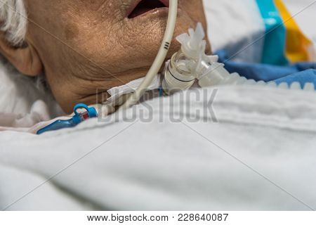 Patient Asian Elder Women 80s Do Tracheostomy Use Ventilator For Breathing Help On Bed In The Hospit