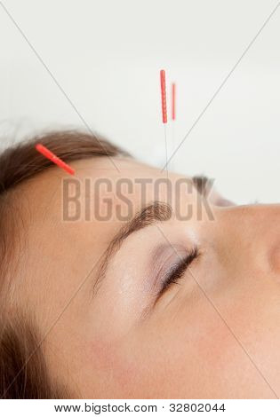 Dettaglio macro di tre aghi fronte paziente