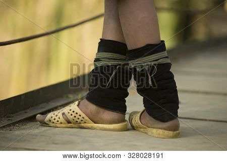 Sapa, Lao Cai, Vietnam - March 21, 2011: Detail Of Hmong Girl Feet. Hmongs Are A Sub-group Of The Mi