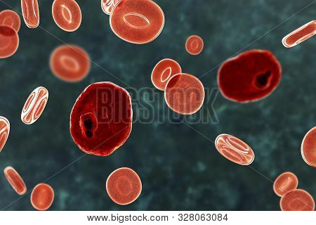 The Malaria-infected Red Blood Cells. 3d Illustration Showing Malaria Parasite Plasmodium Ovale In T