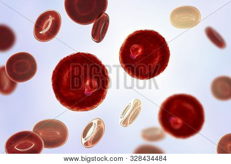 The Malaria-infected Red Blood Cell. 3d Illustration Showing Parasite Plasmodium Malariae In The Sta