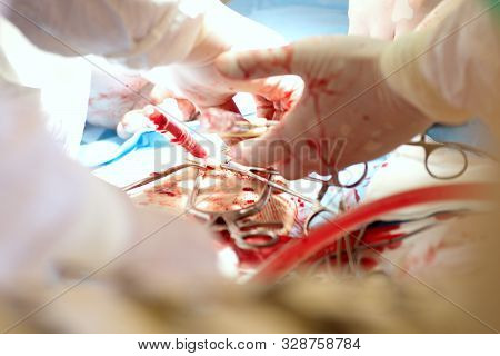 Masked Heart Surgeon Performs Open Heart Surgery