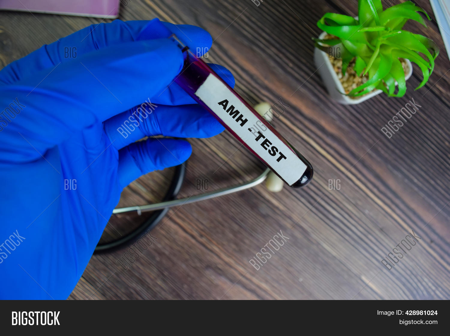 Amh - Test Blood Image & Photo (Free Trial) | Bigstock