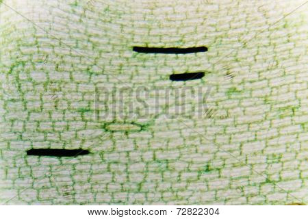Plant Cells Of Demersum