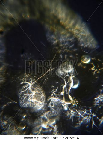 Marcus Kett_microscopy_wasp_017