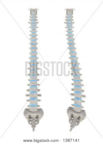 Scoliose