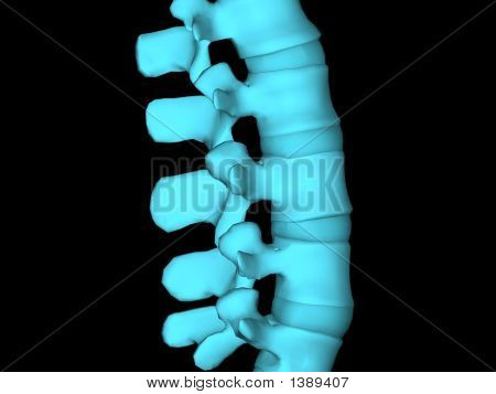 Xray wervelkolom
