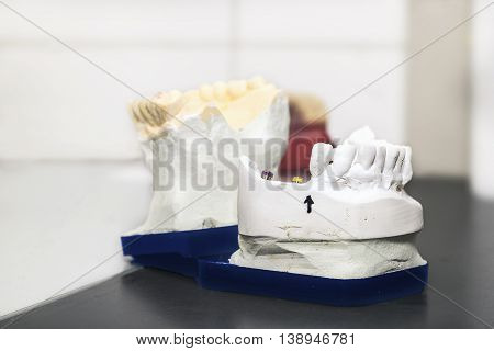 Technical shots of model on a dental prothetic laboratory