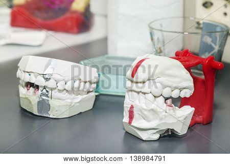 Technical shots of model on a dental prothetic laboratory