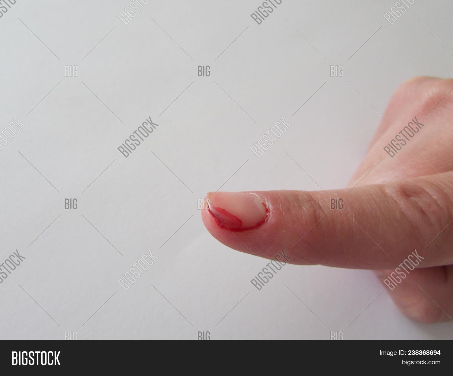 Cut Finger. Bleeding Image & Photo (Free Trial) Bigstock