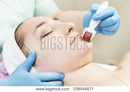 The Woman Undergoes The Procedure Of Medical Micro Needle Therapy With A Modern Medical Instrument D