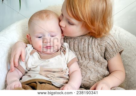 Sister Kisses Brother With Allergies On Cheeks