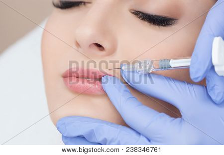 The Doctor Cosmetologist Makes Lip Augmentation Procedure Of A Beautiful Woman In A Beauty Salon.cos