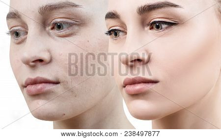 Comparison Portrait Of Young Woman With And Without Makeup. Close-up Shot.