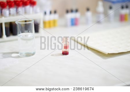 Blood Test.medical Jar With Blood.study Of Human Blood In The Laboratory