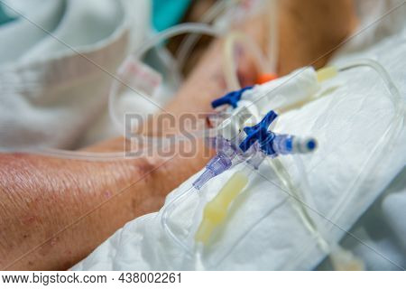 Patient Asian Elder Women 80s Flu Covid19 Do Tracheostomy Use Ventilator For Respiration Breathing H