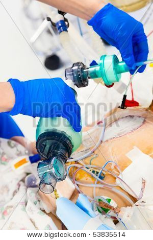 Artificial ventilation with BVM (bag-valve-mask) in ICU