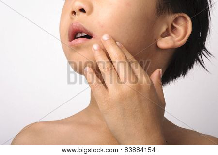 Herpes On Boy Mouth
