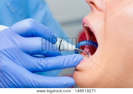 Dentist removing dental calculus, toned image, horizontal image
