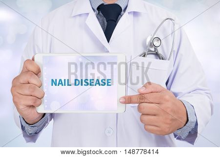 NAIL DISEASE Doctor holding digital tablet doctor work to touch hand