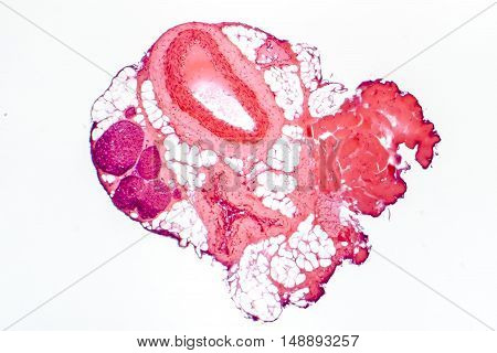 Light micrograph of a muscular artery, vein and nerves. Artery has thicker wall than vein. Light microscopy, hematoxylin and eosin stain, magnification 40x