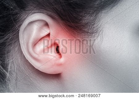 Close Up Of Female Ear With Source Of Pain