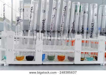 Laboratory Test For Carbohydrate And Protein Determination: Lugol, Biuret, Xanthoproteic, Molish, Ni