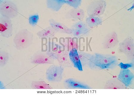 Squamous Epithelial Cells Under Microscope View For Education Histology. Human Tissue.
