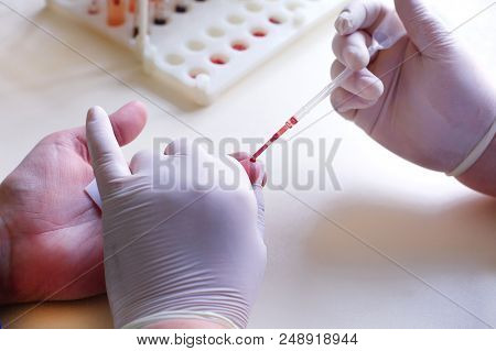Doctor Takes Blood Sample From A Patient's Finger