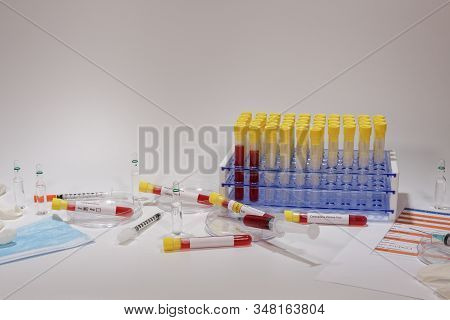 Coronavirus 2019-ncov World Outbreak Tests On Microbiology Lab. Clinical Tests For Wuhan Virus With 