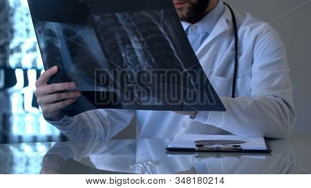 Male Pulmonologist Looking At Lungs X-ray, Observations And Diagnosis, Hospital