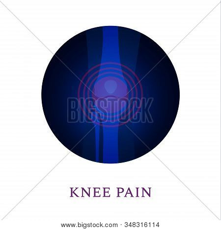 Knee Joint X-ray Medical Template For Ortho