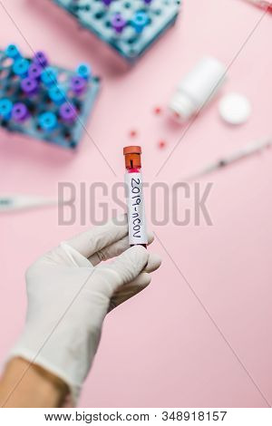 Imunolog Holding A Blood Tube Contaminat With Coronavirus