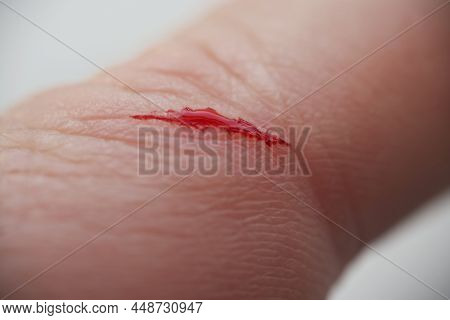 Close-up Of Man With Injured Finger, Bleeding Blood On Open Cut Wound. Macro Of Cut Made With Sharp 