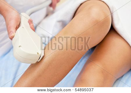 Laser hair removal on ladies legs